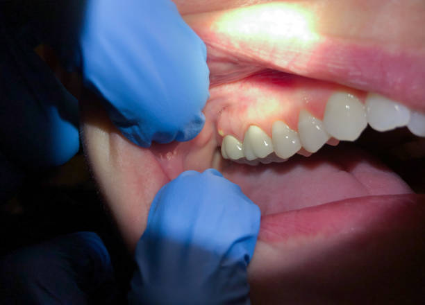 Best Teeth Whitening  in China, TX